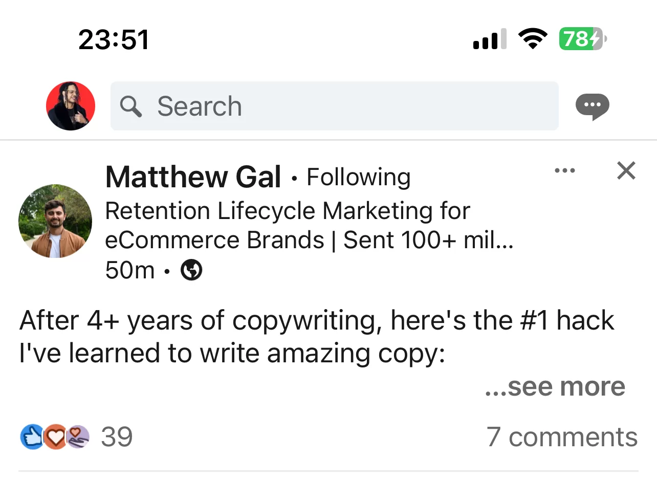 Linkedin hook example how to write a hook for your linkedin post